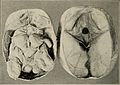 Nervous and mental diseases (1908) (14755550006).jpg