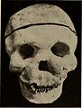 Nervous and mental diseases (1908) (14591670608).jpg