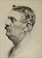 Nervous and mental diseases (1908) (14591647490).jpg