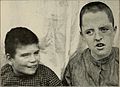 Nervous and mental diseases (1908) (14591894158).jpg