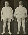 Nervous and mental diseases (1908) (14591865517).jpg