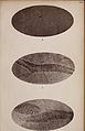 American journal of insanity (1874) (14592226000).jpg