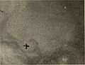 Nervous and mental diseases (1919) (14801581833).jpg