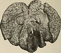 Nervous and mental diseases (1919) (14594960658).jpg