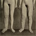 Nervous and mental diseases (1919) (14781383892).jpg
