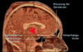 Hypothalamus-deu.png
