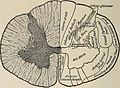 Nervous and mental diseases (1919) (14781279342).jpg