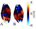 File:A-MRI-Compatible-Combined-Mechanical-Loading-and-MR-Elastography-Setup-to-Study-Deformation-Induced-pone.0169864.s003.ogv