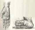 Heubach orangutan hand and foot.jpg