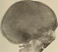 Nervous and mental diseases (1919) (14781730125).jpg
