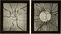 Nervous and mental diseases (1919) (14758466766).jpg