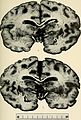 Bulletin of the Massachusetts Department of Mental Diseases (1920) (14586777278).jpg