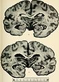 Bulletin of the Massachusetts Department of Mental Diseases (1920) (14773082142).jpg
