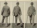 Nervous and mental diseases (1919) (14594906359).jpg