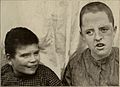 Nervous and mental diseases (1919) (14758806906).jpg