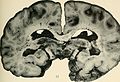 Bulletin of the Massachusetts Department of Mental Diseases (1920) (14771065614).jpg