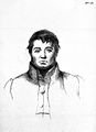 A. Morison, Outlines of lectures...; male patient, aged 32 Wellcome L0023133.jpg