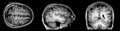 BrainMRI3planes.gif